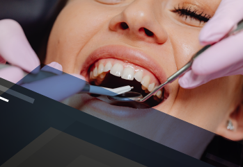 Atualização em cirurgias periodontais - setembro 2022 791120 