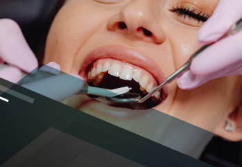 Atualização em cirurgias periodontais 780592 
