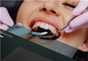 Atualização em cirurgias periodontais 780592